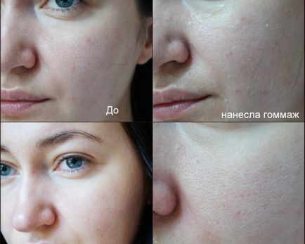 Ce este un exfoliant pentru față și corp, cum funcționează, eficiența (peeling-ul exfoliant) Ce este un exfoliant pentru față și corp, cum funcționează, eficiență