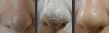 Ce este un exfoliant pentru față și corp, cum funcționează, eficacitatea (ceea ce exfolierea și cum să-l folosească) Ce este un exfoliant pentru față și corp, cum funcționează, eficiență