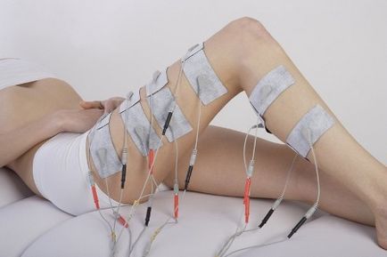 Metoda Elektrolipoliz de a face cu exces de grăsime (elektrolipoliz) Metoda Elektrolipoliz de a face cu exces de grăsime