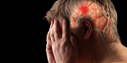 Accident vascular cerebral și consecințele sale - care sunt șansele de supraviețuire