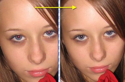Din cauza a ceea ce se întâmplă și cum să eliminați efectul de ochi roșii din fotografie