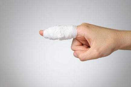 Cum de a trata un abces pe metodele sale degetelor traditionale (crema de maini) Cum de a trata un abces pe metodele sale deget populare