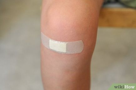 Cum de a preveni apariția de cicatrici