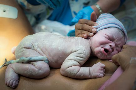 Care este nașterea unui copil înainte de naștere fotografie, fotografie după naștere după fotografie cezariană, fotografie