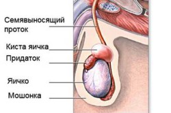 Cauzele Chist testiculare de sex masculin, simptome, tratament