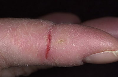 Unguent de crăpături pe mâini cu un efect de vindecare - Revizuirea remedii populare creme și unguente din sec
