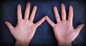 Calusurile pe mâinile cauze ale simptomelor, semne, tratament și diagnostic