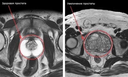 pelvină mri arată că, pregătirea, lectura