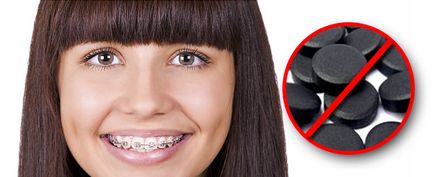 Albirea dinților reteta de cărbune activat, recenzii, fotografii și video