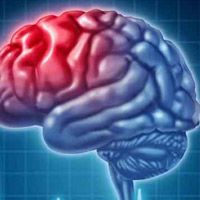 Pe ce este principalele cauze de accident vascular cerebral