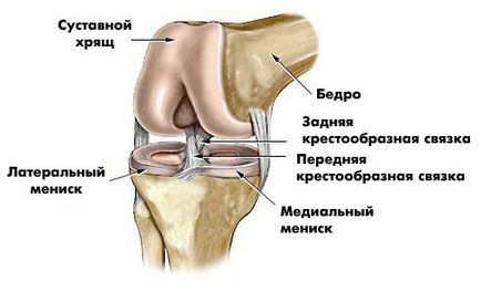 Deteriorarea meniscul genunchiului, ce simptomele și tratamentul bolii