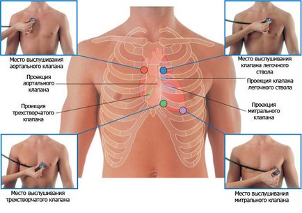 murmur cardiac la adulți cauze, tipuri, simptome și tratament