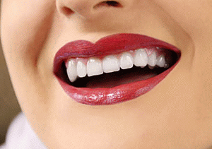 Instalarea de implanturi dentare și contra, tipuri, preț (preț) Instalarea de implanturi dentare și contra, tipuri, preț