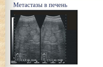 ficat Uzi care arată parametrii de decodare și rata (ficat) ficat Uzi care arată indicatorii de decodare și rata
