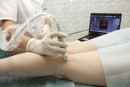 navele Uzi și venele picioarelor trebuie să știe (trebuie să) navele Uzi și venele picioarelor trebuie să știe