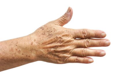 Atenție să se ocupe de modul de a încetini îmbătrânirea pielii mâinilor