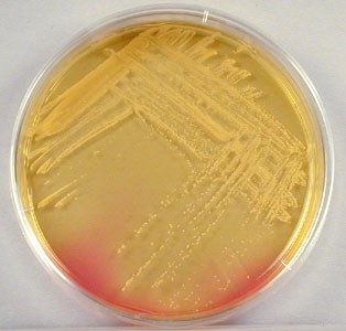 Staphylococcus aureus în gât simptome, tratament fotografie bacteriofag