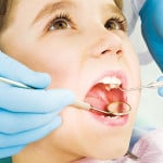ata dentara, modul de utilizare și de a alege