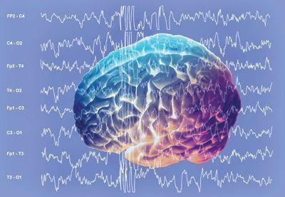 alfa creier ritmuri descriere, caracteristici și funcții