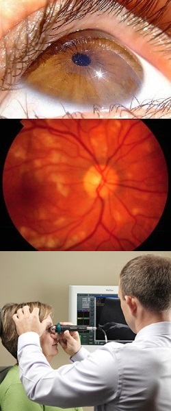 Retiniana angiopatie - tipuri, cauze, simptome, diagnostic si metode de tratament