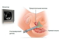 tipuri de mașini cu ultrasunete și principii de funcționare