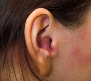 Boli ale urechii