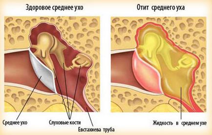 Boli ale urechii umane care sunt simptomele și tratamentul, fotografie, prevenirea