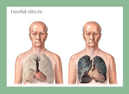 Ce se întâmplă cu corpul în timpul fumatului, plămânii unui fumător