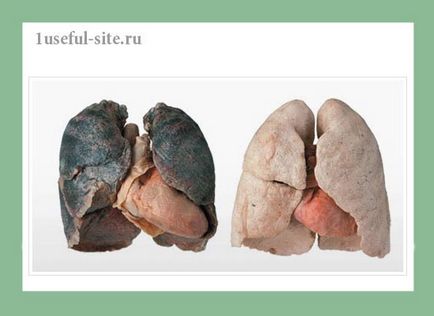 Ce se întâmplă cu corpul în timpul fumatului, plămânii unui fumător