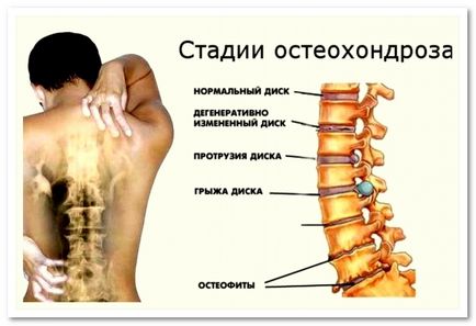 Ce este durerea de spate și cum să-l trateze