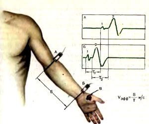 extremitățile superioare și inferioare Electroneuromyography - cum și în cazul în care pentru a face prețul