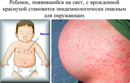 Etapele de pregătire a femeilor pentru FIV și posibile complicații (preparare) Etapele de femei pregătirea pentru FIV și posibilele complicații