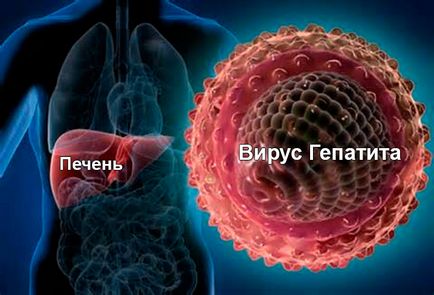 Hepatita B și ceea ce este și modul în care se transmite, simptome ale unei boli infecțioase, diagnostic și tratament al Botkin