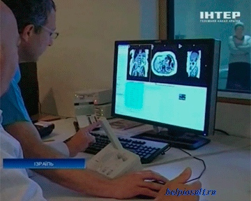 Un an după un accident vascular cerebral - Tratamentul Inimii