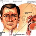 De col uterin infectare - cauze, simptome și tratament