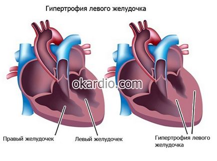 ACE lista de inhibitor de droguri, ceea ce este, mărturia eficienței lor