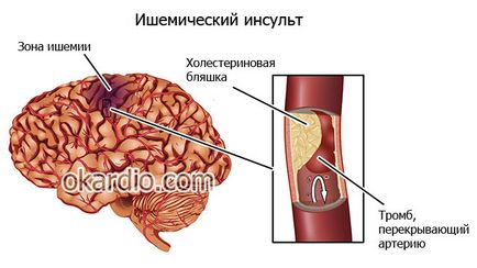 ACE lista de inhibitor de droguri, ceea ce este, mărturia eficienței lor