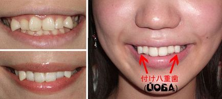 Yoba strâmbă dinți - tendința principală în Japonia! Fotografii și clipuri video!