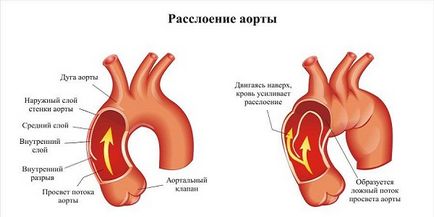 Cum inima doare simptome și semne