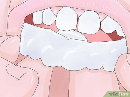 Cum de a folosi un gel de albire a dintilor