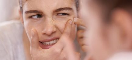 Cum să scapi de acnee pe adolescent acnee fata la adolescenti - tratamentul acneei adolescente