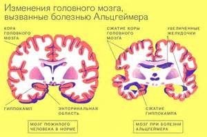 Așa cum a format gri spinal și alungită secundară, situată în cazul în care ambele (spinal) Deoarece măduva spinării este formată de substanța cenușie a bulbului rahidian și secundar, în cazul în care este în același timp