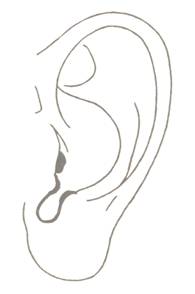 Cum de a identifica boala la lobul urechii