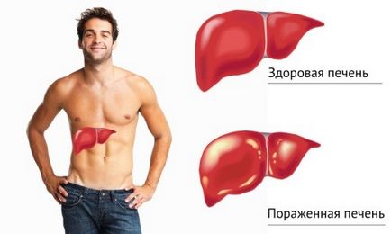 Cum de a determina hepatita și formele și tipurile de boli, cum să verificați
