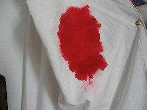 Cum să se spele sângele de pe hainele la domiciliu