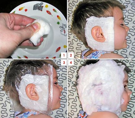 Cum de a face o compresa pe urechea unui copil de încălzire, cu vodca sau alcool