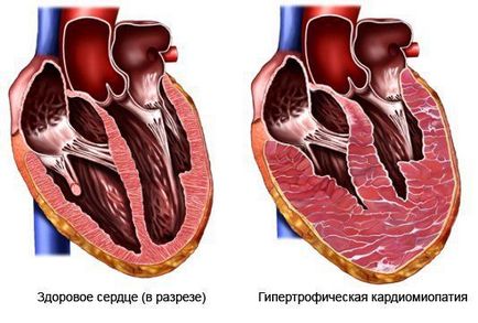Cum de a instrui inima 1 (inima) Cum de a instrui inima 1