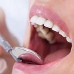 Cum de a consolida smalțul dentar 5 sfaturi!