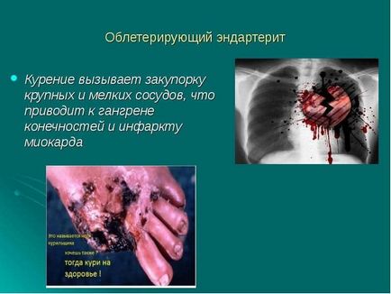 Imagini cu privire la pericolele fumatului pentru elevi