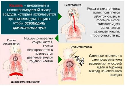 Tipuri de tuse, cauze, simptome, cum de a vindeca, decât pentru a trata